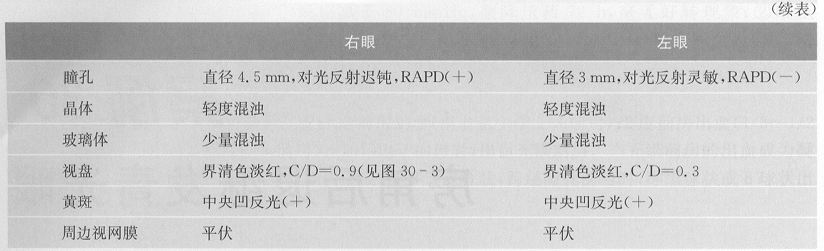 ZY016_154_1.gif